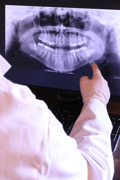 Best Emergency Dental Care for Broken or Chipped Teeth in Wilson, WY