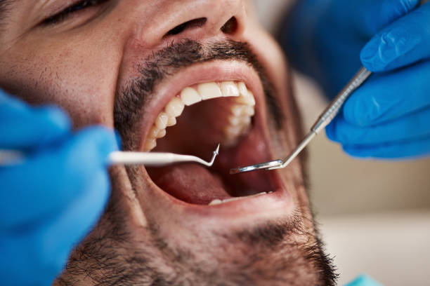 Best Emergency Tooth Extraction in Wilson, WY