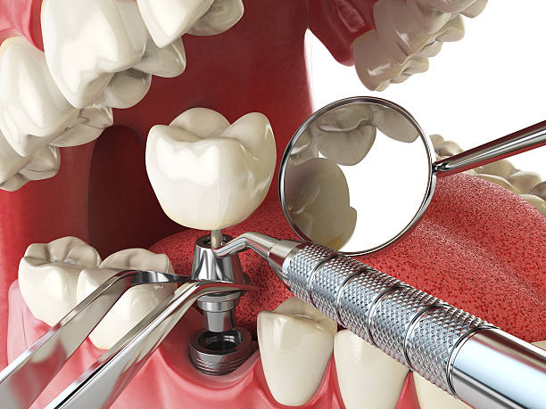 Best Emergency Treatment for Dental Infections or Abscesses in Wilson, WY