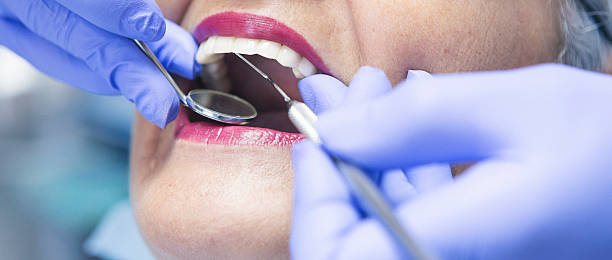 Best Emergency Root Canal Treatment in Wilson, WY