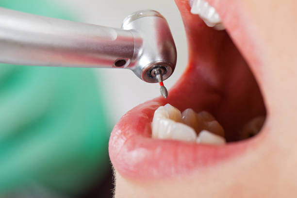 Best Urgent Care for Lost Fillings or Crowns in Wilson, WY